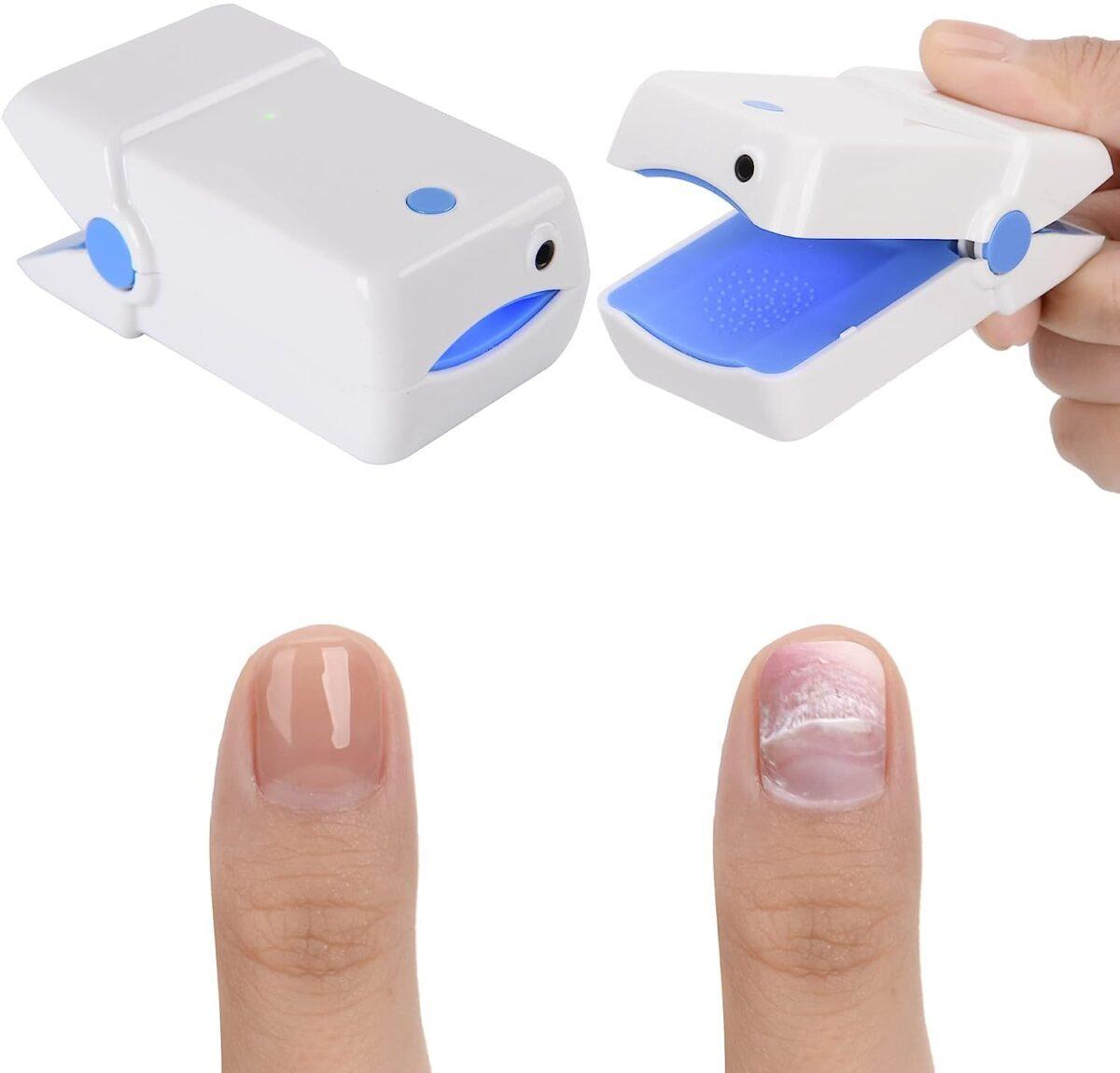 Nail Fungus Device 2