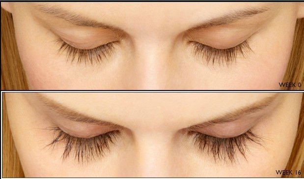 FEG Eyelash Enhancer 4