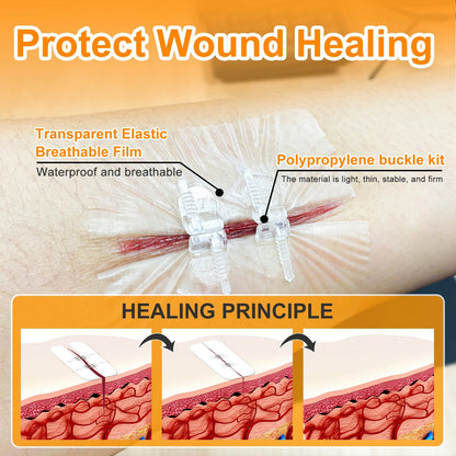 Wound Closure Device-4PCS 2