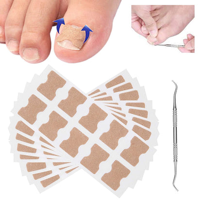 Ingrown Toenail Corrector Patches 2