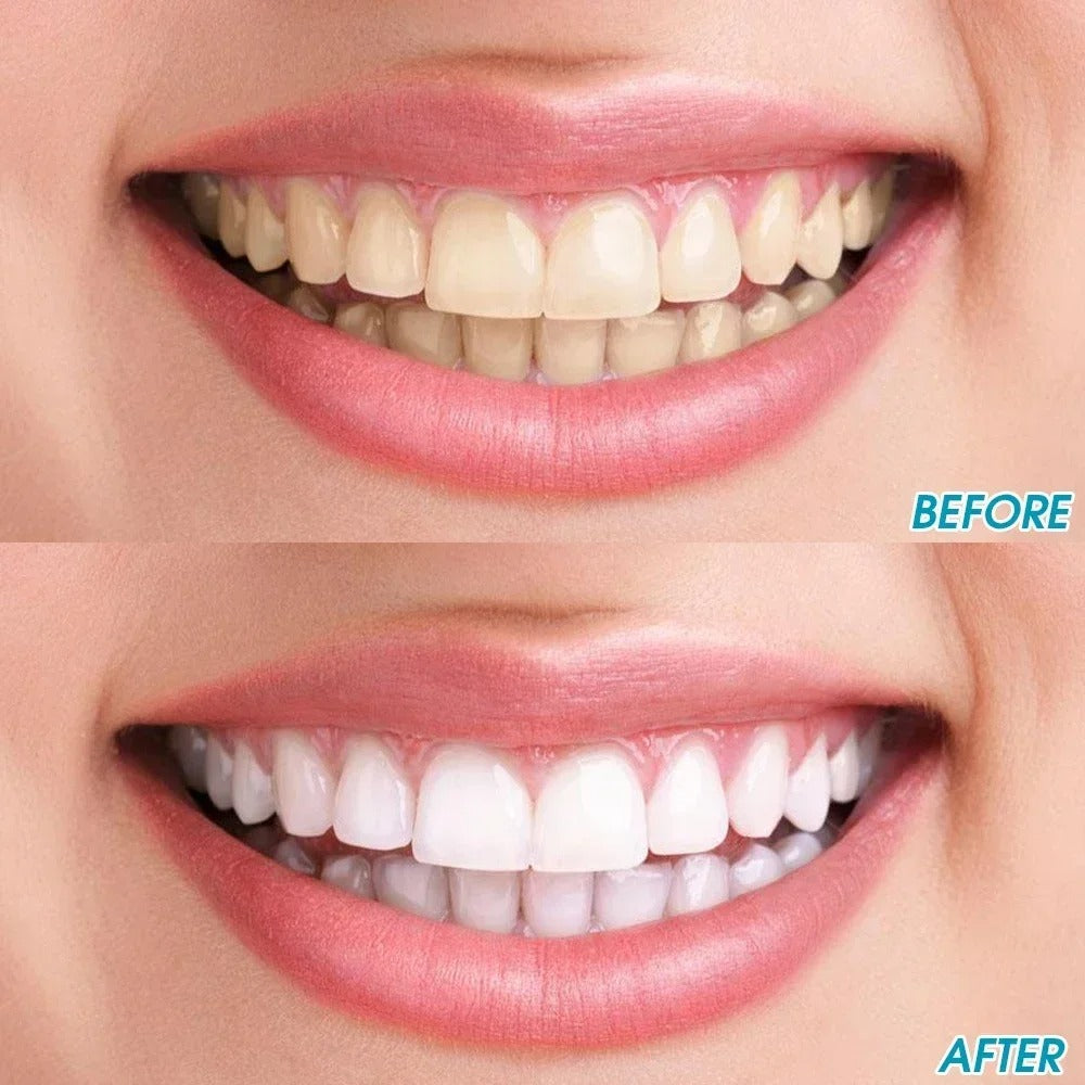 Tooth Stain Cleaning Brush-3PCS 2