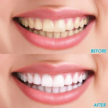 Tooth Stain Cleaning Brush-3PCS 2