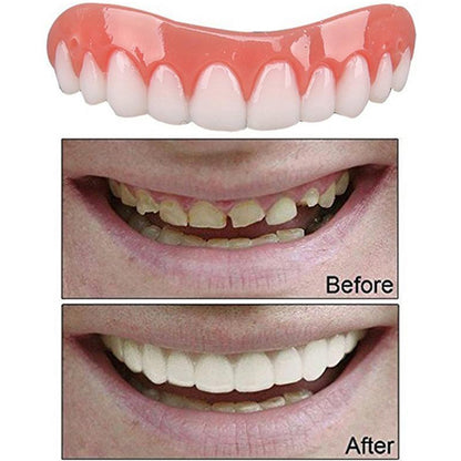 Perfect Instant Smile 2