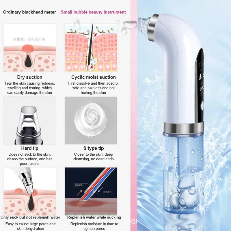 Hydrodermabrasion 2