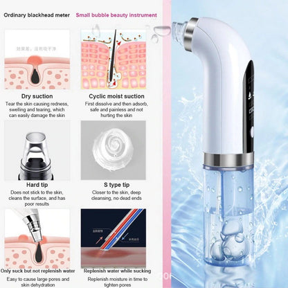 Hydrodermabrasion 2