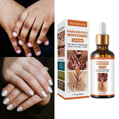 Acanthosis Nigricans Therapy Oil 2