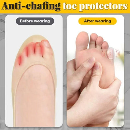Silicone Anti-friction Toe Protector 2