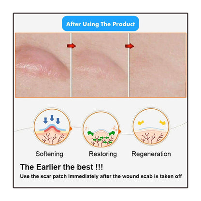 MIRACLE STRETCH MARK + SCAR REMOVAL SHEETS 2