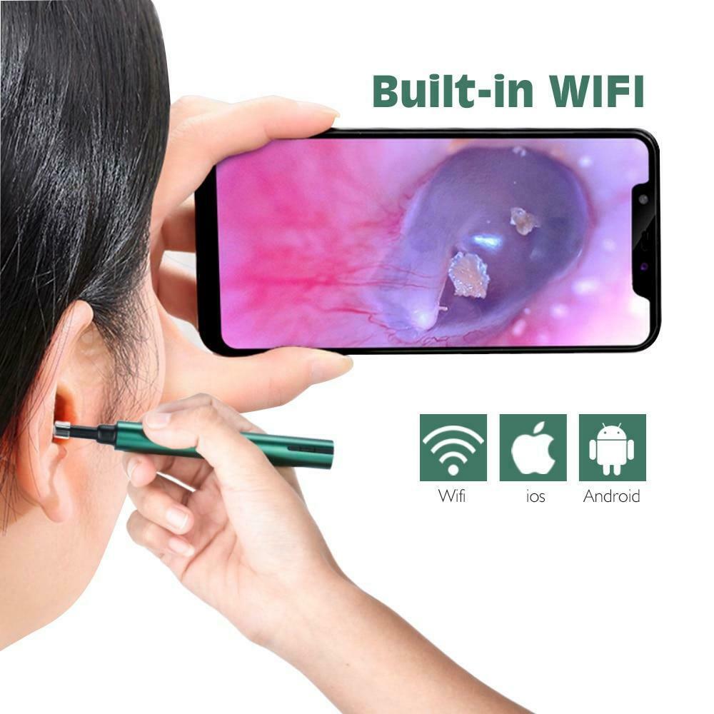 VESPANI EAR WAX REMOVER 2