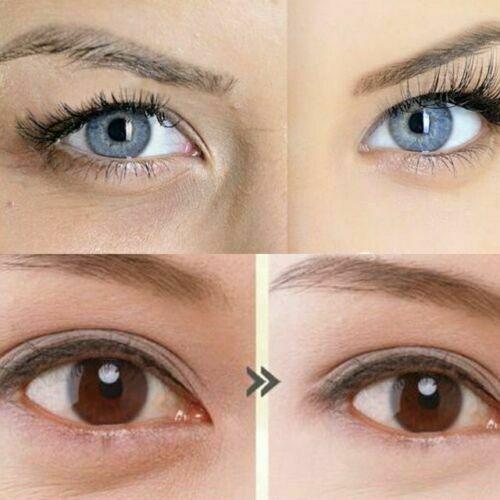Instantly Ageless Face Lift Cream 2