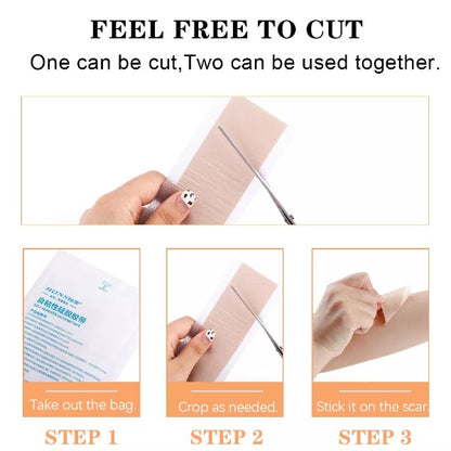 Surgery Scar Removal Silicone Gel Patch 2