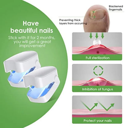Light Therapy Device For Toenail Diseases 2