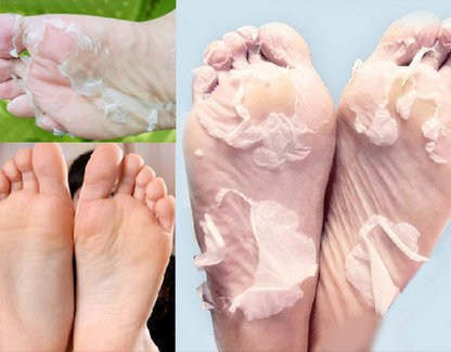 Baby Foot Peeling 2