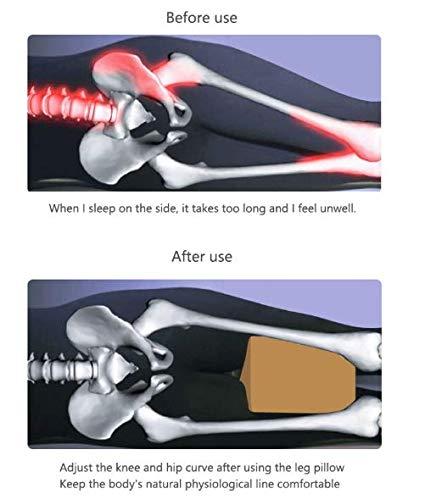 Orthopedic leg pillow 2