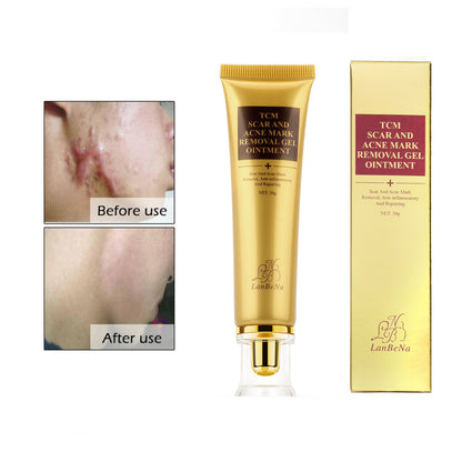 ACNE SCAR CREAM 2