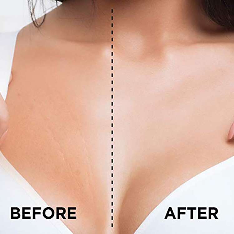 Silicone Anti Wrinkle Chest Pads 2