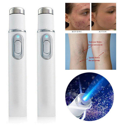 Skin Spots Removal Laze Pen 2