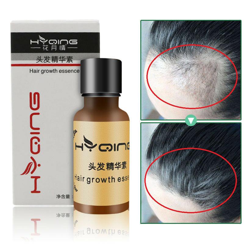 Hair Growth Essence 2