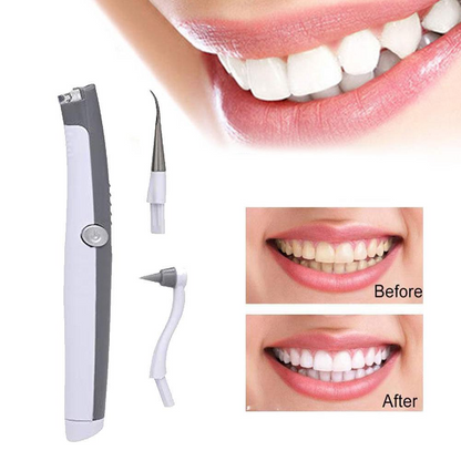 Sonic Scaler Ultrasonic Tooth Stain/Plaque Remover 2