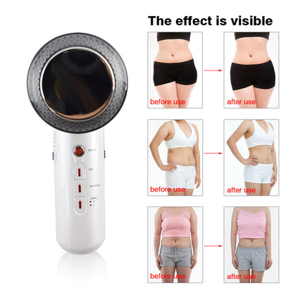 Ultrasonic Cavitation Slimming Machine 2