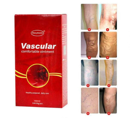 VARICOSE VEINS REMOVAL CREAM 2