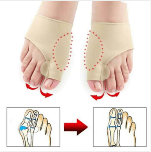 Bunion Corrector 2