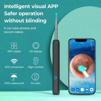 Wireless Smart Visual Ear Cleaner 2