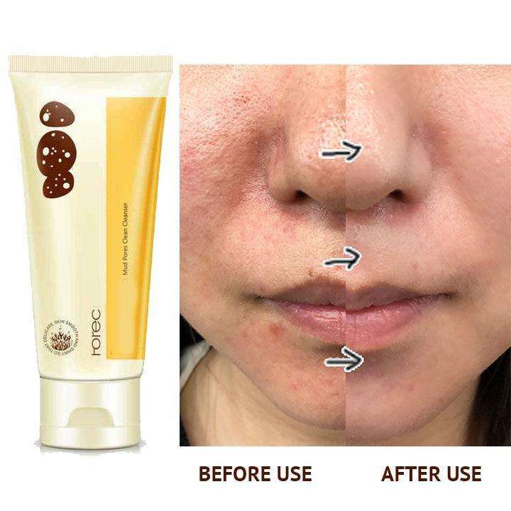 Pore Terminator Cleansing Foam 2