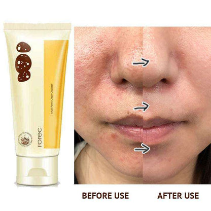 Pore Terminator Cleansing Foam 2