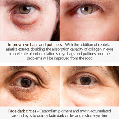 Magic Eye Cream 2