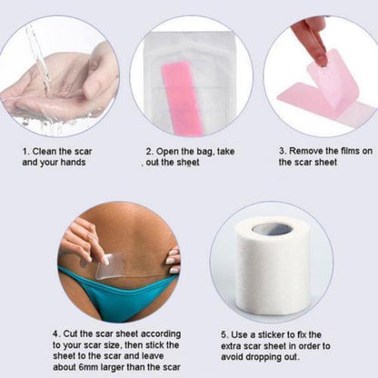 MIRACLE STRETCH MARK + SCAR REMOVAL SHEETS 2