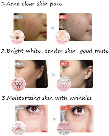 LOYAL LED THERAPY MASK 2