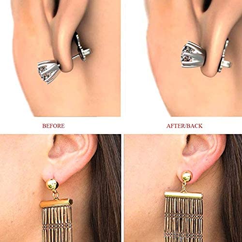 Revolutionary Earing Lifter for Stretched Earlobs 2