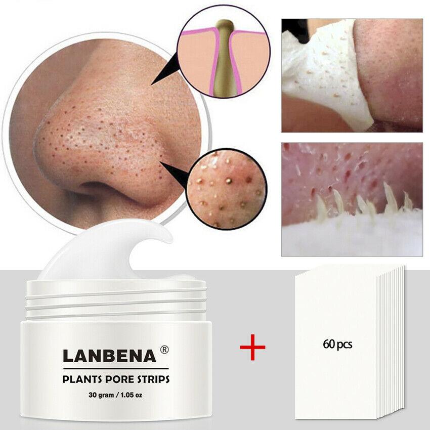 BLACKHEAD STRIP 2