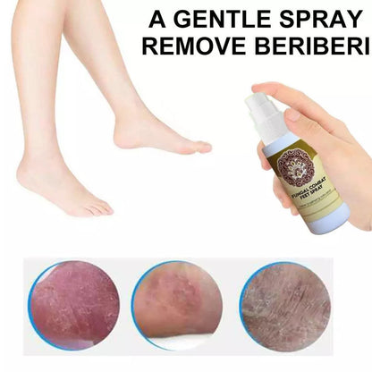 Anti-Fungal Treatment Spray 2