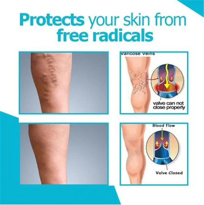 Varicose Veins Miracle Cream 2