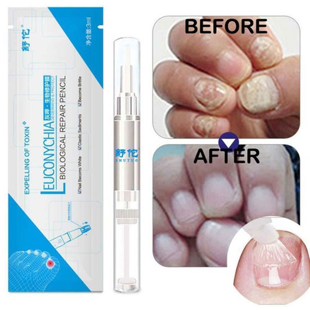 Eucony Fast Acting Toenail Cure – 3ml (PACK OF 4) 3
