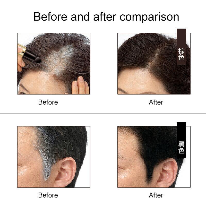 NATURAL GREY HAIR REMOVER 3