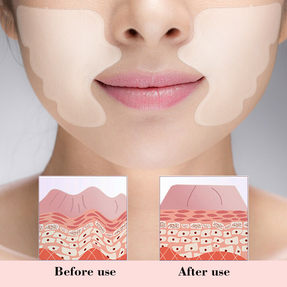 Reusable Silicone Patches 3
