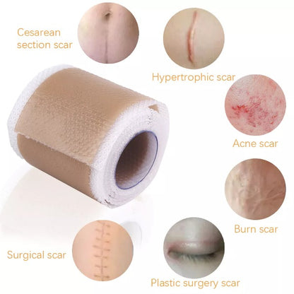 Surgery Scar Removal Silicone Gel Patch 3