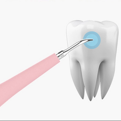 Electric Dental Calculus Remover 2