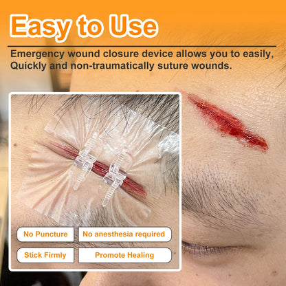 Wound Closure Device-4PCS 3