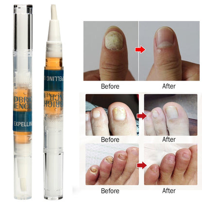 Eucony Fast Acting Toenail Cure - 3ml (PACK OF 4) 3