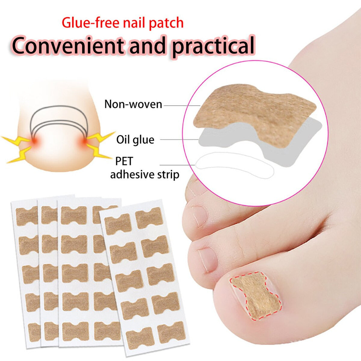 Ingrown Toenail Corrector Patches 3