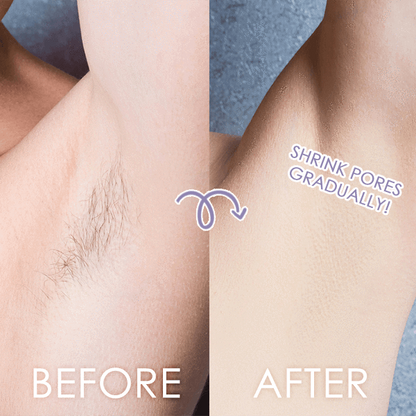 Perfect Hair Remover 3