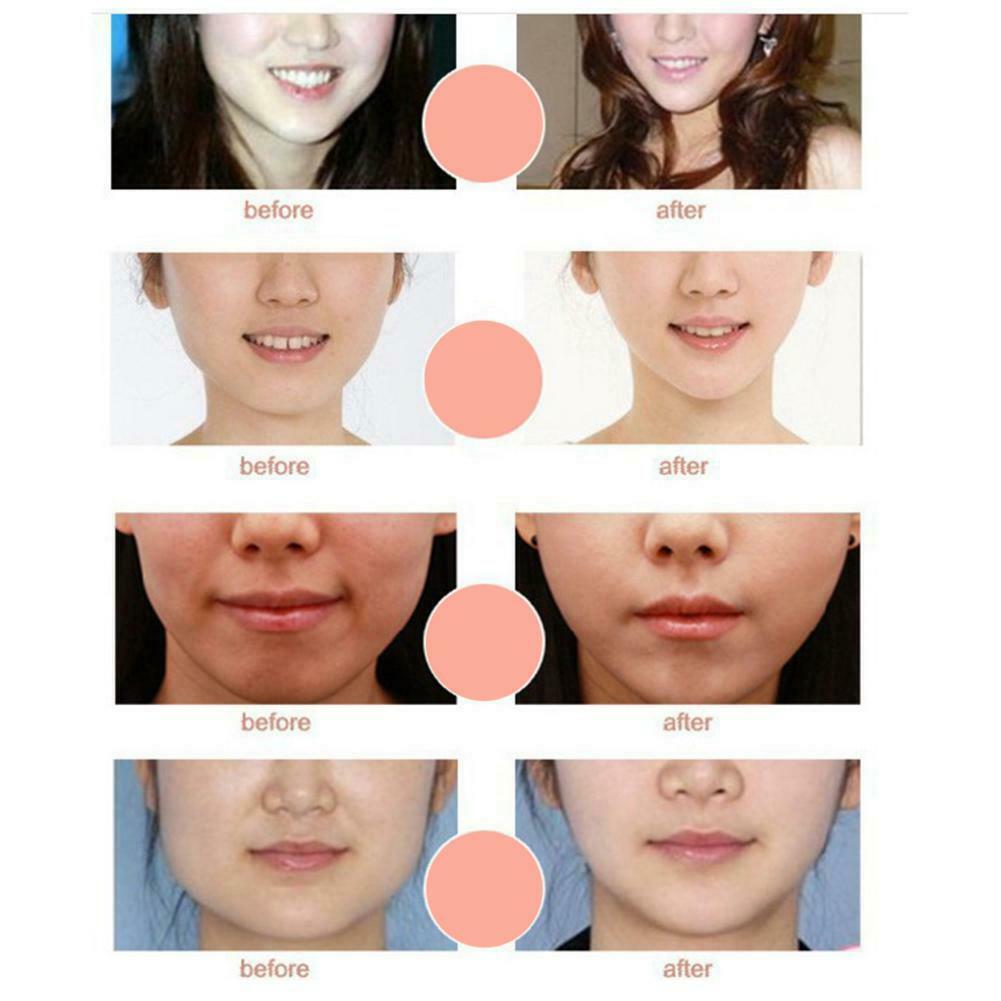 Face Lifting Mask 3