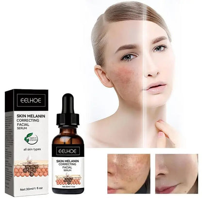 Skin Melanin Correcting Facial Serum 3
