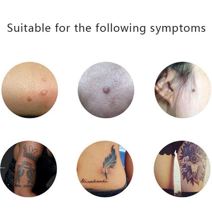 SKIN TAG & MOLE ERASER 3