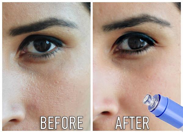 Perfect Pore Cleanser 3