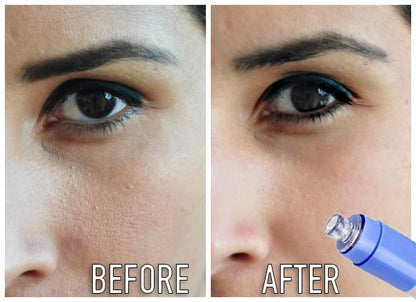 Perfect Pore Cleanser 3